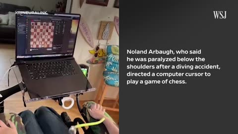 Man With Elon Musk's Neuralink Brain Chip Uses Mind Control To Play Chess