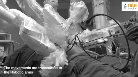 Watch Prof. Mohamed Rela | performing a Scarless Robotic |Liver Donor Surgery|