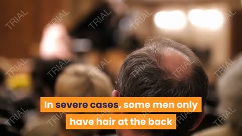 CAUSES OF HAIR LOSS