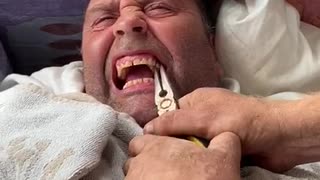 Man Pulls His Buddy's Loose Tooth Out During Quarantine