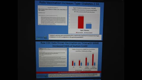 CDC study Vaccinated v/s Unvaccinated 1999