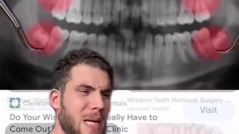 Truth About Wisdom Teeth Removal