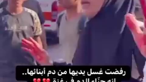 Injured Palestinion Lady Bloods in Her Hand, Just Saying that NO GoD But Allah
