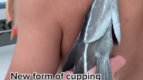 New form of cuppingGreat for recovery