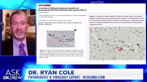 mRNA Spike Protein throughout the Body - Dr. Ryan Cole MD, w' Dr Drew MD, Dr. Kelly Victory MD