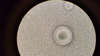 Home made goats milk formula under a microscope