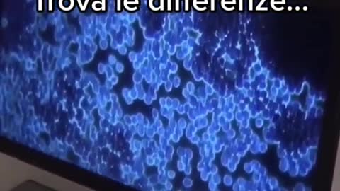 Ottimo video sulle cure del DR. Giovannini per gli effetti collaterali da vaccini