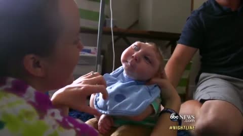 'Miracle Baby' Born Without Most of His Brain Defying Odds | ABC News