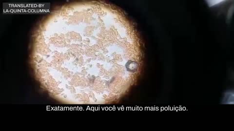 Análise ao microscópio ótico uma gota de 🩸 de uma pessoa 💉 (La Quinta Columna International)