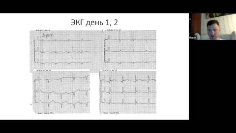 Заседание №174 в записи