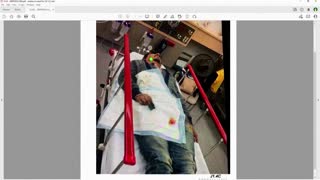 Depp details hospital visit, injuries allegedly from Heard
