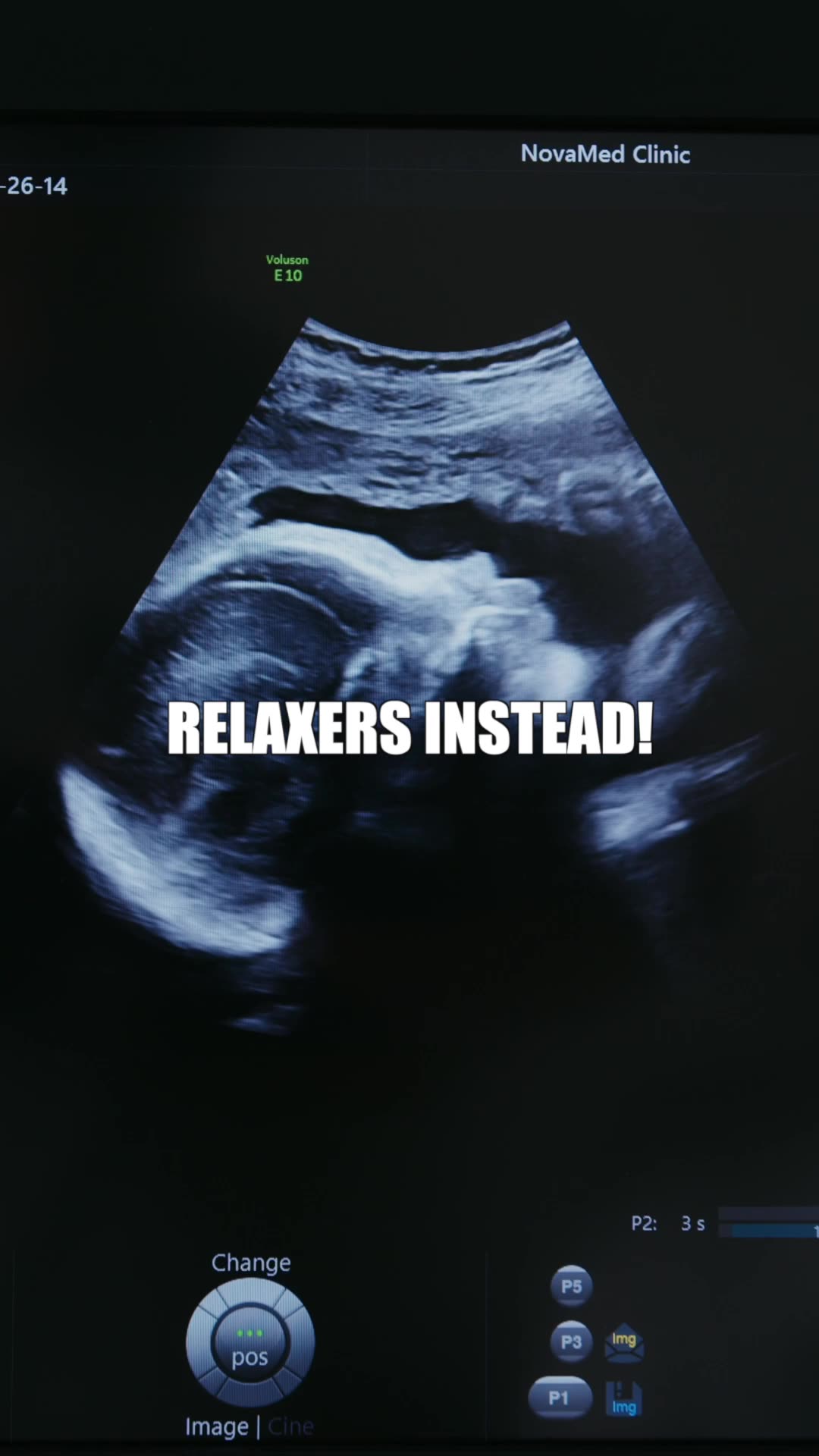 NOBODY KNEW BABIES FEEL PAIN DURING SURGERY! baby didyouknow facts 