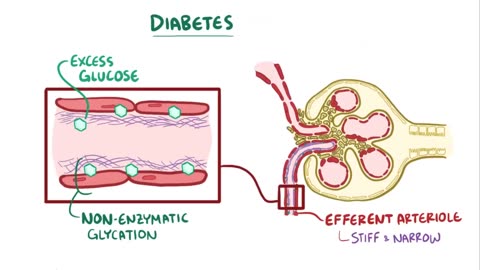 0:29 / 8:39 Chronic kidney disease - causes, symptoms, diagnosis, treatment, pathology