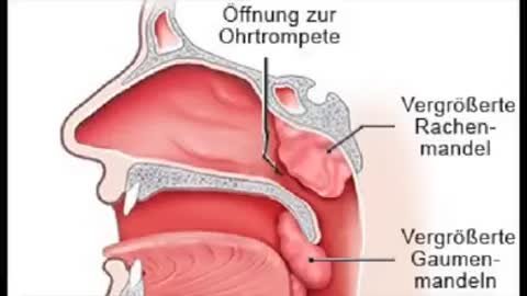 Dr. Thoma: Was unfachmännische Testungen anrichten können