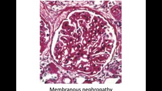 Renal Pathology Part 1