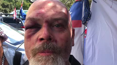 Watch! sergeant punches and gouges the eyes of anti mandate demonstrator!👀