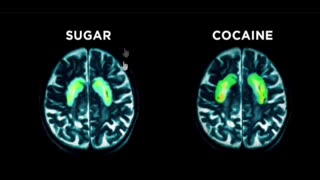 NEW Research: Sugar vs Cocaine #sugar #diabetes #addictionrecovery