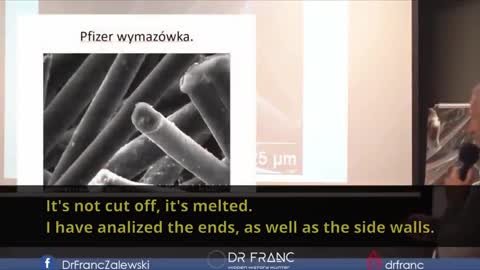 Dr Franc Zalewski Finds Strange Aluminum Lifeform Tentacled Parasite in Covid Vaccine