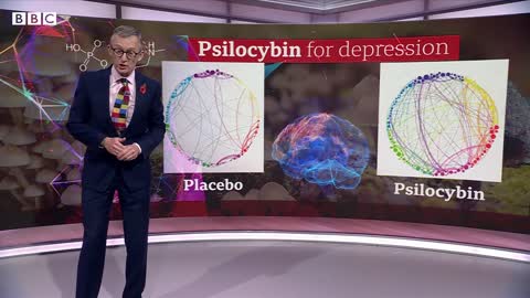Magic-mushroom drug can treat severe depression, trial suggests - BBC News