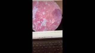 New video of live and blood analysis by Dr Robert Young