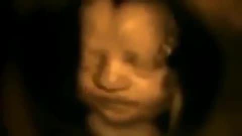 Scan Captured Footage Of What Unborn Babies Do In The Womb