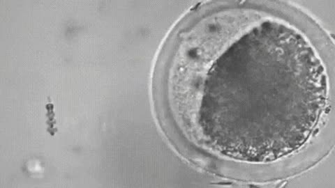 NANOBOT PICKS UP SPERM AND INSEMINATES EGG W/IT