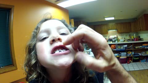 Adorable little girl asks for help with loose tooth