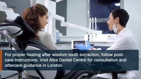 Brushing Your Teeth After Wisdom Tooth Removal