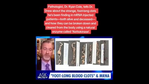 Dr Ryan Cole on clots...