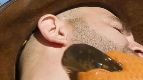 leech therapy real video