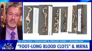 Dr. Ryan Cole on finding Strange Foot Long Clots in mRNA injected Patients.