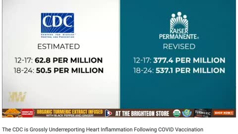 The CDC is Grossly Underreporting Heart Inflammation Following COVID Vaccination