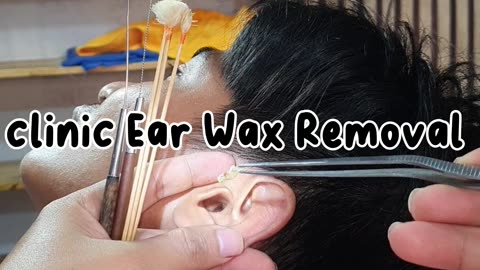 Ear-Cleaning removal ASMR wax