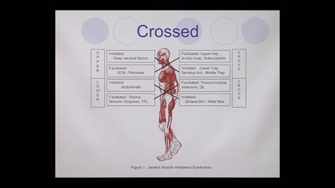 Muscle Imbalances Due to Poor Posture