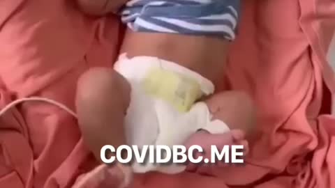 Infant Suffers Horrific Vaccine Side Effects (2021)
