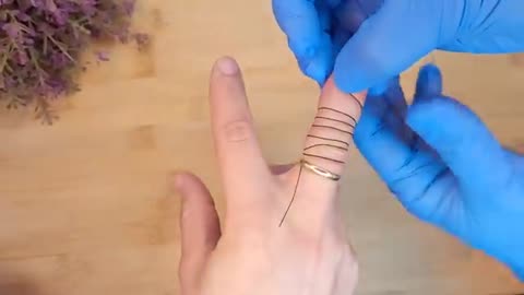 A doctor showed me how to remove the ring that was stuck on my finger