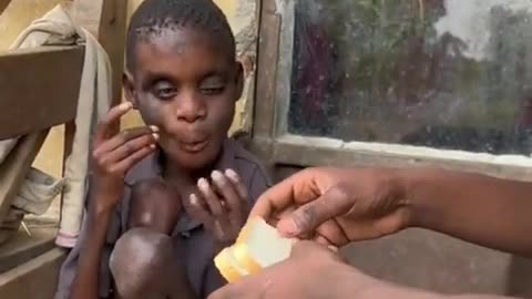 #Hungry #help #suffering #sufferings #poverty #africa #foundation #unicef #children #kids #childrens