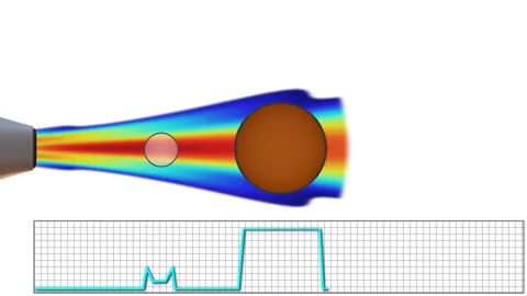 How Does Ultrasound Work?