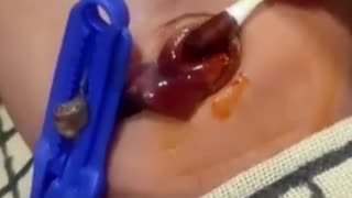 how to clean umbilical cord of new born baby