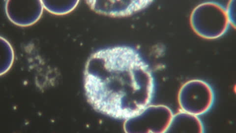 Found in Pfizer in New Zealand: 'Chip' On Edge of Blood Cell