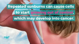 Top Reasons Why Sun Exposure Can Give You Skin Cancer