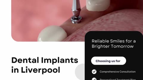 Rediscover Confidence with Expert Dental Implants in Liverpool