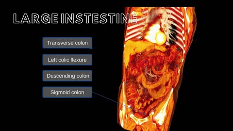 Large Intestine and Umbilical Hernias