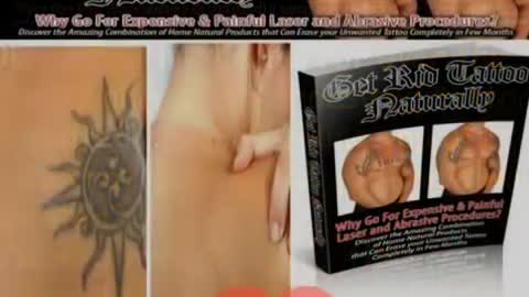 The Cheapest Tattoo Removal Online : Bestseller's Get Rid Tattoo Naturally Limited Offers