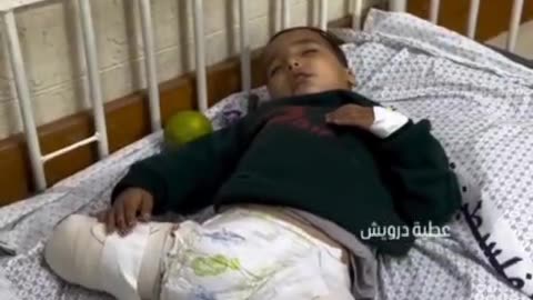 Ahmad Shabat Lost His Whole Family And Both His Legs In An Israeli Airstrike.