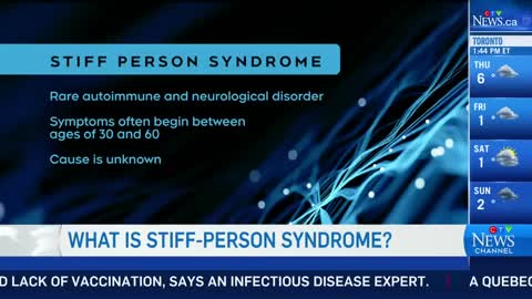 What is stiff person syndrome? Neurologist explains Celine Dion's recent diagnosis