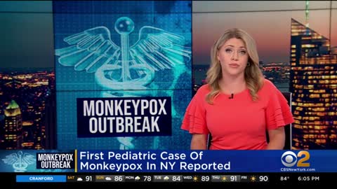First pediatric case of monkeypox in New York reported