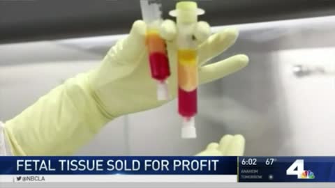 Stem Cell Research Shut Down for Buying Aborted Baby Parts
