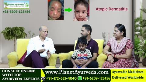 Successful Treatment of Atopic Dermatitis in Ayurveda - Real Story