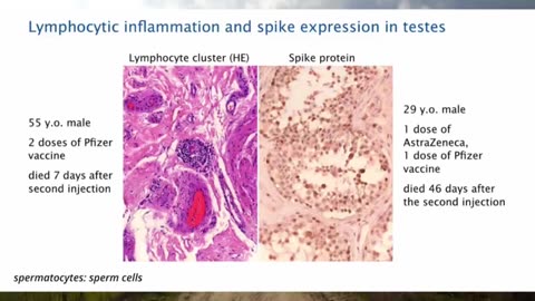 Pathologist Arne Burkhardt Final Interview – Revealing The Grave Dangers Of MRNA Vaccines 12/23/23